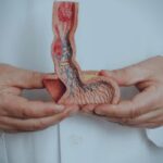 Higiene íntima precária pode causar câncer de pênis, alerta urologista