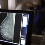 Outubro Rosa: como receber o auxílio-doença em tratamento de câncer