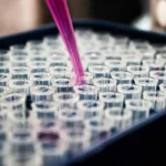 Pesquisas brasileiras avançam no diagnóstico de Alzheimer