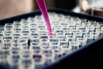 Pesquisas brasileiras avançam no diagnóstico de Alzheimer