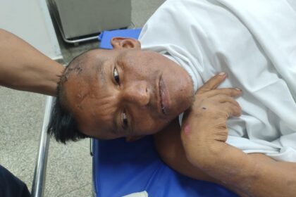 Hospital João Lúcio pede ajuda para localizar familiares de paciente internado sem identificação