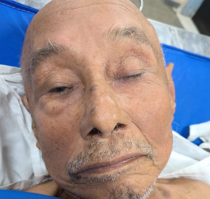 HPS João Lúcio pede ajuda para localizar familiares do paciente Fábio Pinheiro, de 75 anos