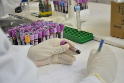 Polícia Científica identifica quatro corpos localizados entre os anos de 2022 e 2024