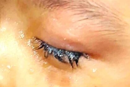 Criança de 2 anos cola os próprios olhos e é internada em hospital no interior do AM